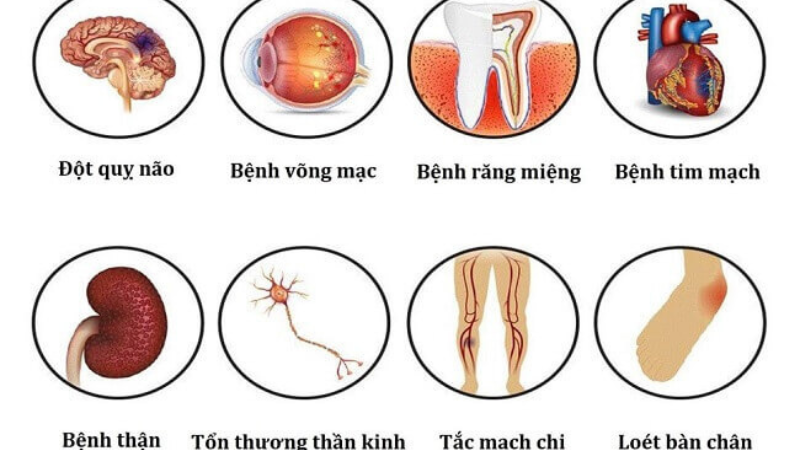 biến chứng của bệnh tiểu đường